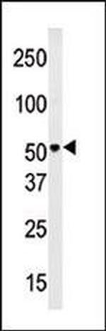 PMAT Antibody in Western Blot (WB)