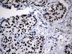 POLR2A Antibody in Immunohistochemistry (Paraffin) (IHC (P))