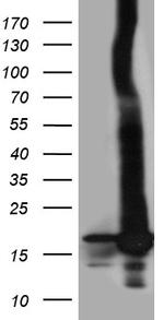 POLR2H Antibody in Western Blot (WB)