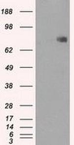 POR Antibody in Western Blot (WB)