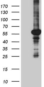 PPARD Antibody in Western Blot (WB)