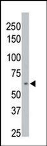 PPM1D Antibody in Western Blot (WB)