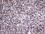 PPP1R8 Antibody in Immunohistochemistry (Paraffin) (IHC (P))