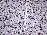 PPP1R8 Antibody in Immunohistochemistry (Paraffin) (IHC (P))