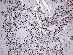 PPP1R8 Antibody in Immunohistochemistry (Paraffin) (IHC (P))