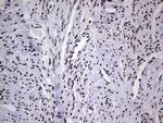 PPP1R8 Antibody in Immunohistochemistry (Paraffin) (IHC (P))