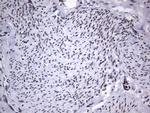 PPP1R8 Antibody in Immunohistochemistry (Paraffin) (IHC (P))