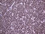 PPP1R8 Antibody in Immunohistochemistry (Paraffin) (IHC (P))