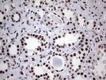 PPP1R8 Antibody in Immunohistochemistry (Paraffin) (IHC (P))