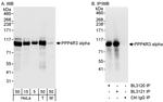 PPP4R3 Alpha Antibody in Western Blot (WB)