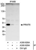 PRMT6 Antibody in Immunoprecipitation (IP)