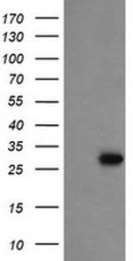 PROSC Antibody in Western Blot (WB)