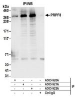 PRPF8 Antibody in Western Blot (WB)