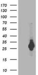 PSMB4 Antibody in Western Blot (WB)