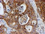 PSMB9 Antibody in Immunohistochemistry (Paraffin) (IHC (P))