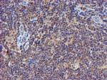 PSMB9 Antibody in Immunohistochemistry (Paraffin) (IHC (P))