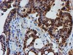 PSMB9 Antibody in Immunohistochemistry (Paraffin) (IHC (P))