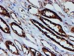 PSMB9 Antibody in Immunohistochemistry (Paraffin) (IHC (P))