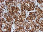 PSMB9 Antibody in Immunohistochemistry (Paraffin) (IHC (P))