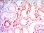 PTH1R Antibody in Immunohistochemistry (Paraffin) (IHC (P))