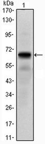 PTH1R Antibody in Western Blot (WB)