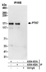 PTK7 Antibody in Western Blot (WB)