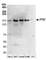 PTK7 Antibody in Western Blot (WB)