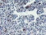 PVRL1 Antibody in Immunohistochemistry (Paraffin) (IHC (P))