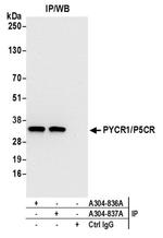 PYCR1/P5CR Antibody in Western Blot (WB)