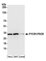 PYCR1/P5CR Antibody in Western Blot (WB)