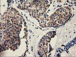 PYCR2 Antibody in Immunohistochemistry (Paraffin) (IHC (P))