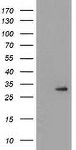 PYCR2 Antibody in Western Blot (WB)