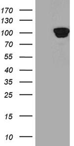 PYGM Antibody in Western Blot (WB)