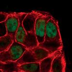 Phospho-p53 (Ser15) Antibody in Immunocytochemistry (ICC/IF)