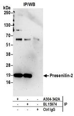 Presenilin-2 Antibody in Western Blot (WB)