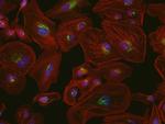 Mouse IgG (H+L) Cross-Adsorbed Secondary Antibody in Immunocytochemistry (ICC/IF)