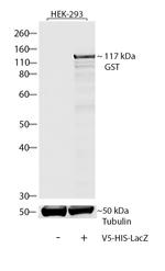 V5 Tag Antibody in Western Blot (WB)