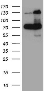 RAD21 Antibody in Western Blot (WB)