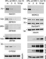 RANGAP1 Antibody in Western Blot (WB)