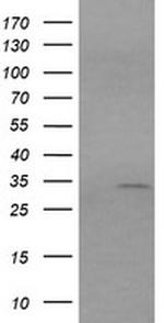 RARRES1 Antibody in Western Blot (WB)