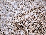 RB1 Antibody in Immunohistochemistry (Paraffin) (IHC (P))