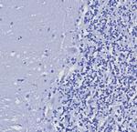 Cytokeratin 5/6 (Basal, Myoepithelial and Mesothelial Cell Marker) Antibody in Immunohistochemistry (Paraffin) (IHC (P))