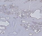 Cytokeratin 5/6 (Basal, Myoepithelial and Mesothelial Cell Marker) Antibody in Immunohistochemistry (Paraffin) (IHC (P))