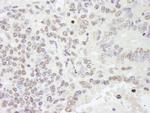 RBM25/RED120 Antibody in Immunohistochemistry (IHC)