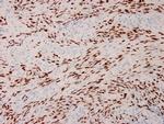 Human Herpes Virus 8 (HHV8) Antibody in Immunohistochemistry (Paraffin) (IHC (P))