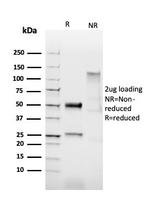 HPV-16 (Human Papilloma Virus 16) Antibody in SDS-PAGE (SDS-PAGE)