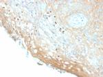 HPV-16 (Human Papilloma Virus 16) Antibody in Immunohistochemistry (Paraffin) (IHC (P))