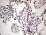 RET Antibody in Immunohistochemistry (Paraffin) (IHC (P))