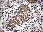 RIPK3 Antibody in Immunohistochemistry (Paraffin) (IHC (P))