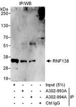 RNF138 Antibody in Immunoprecipitation (IP)